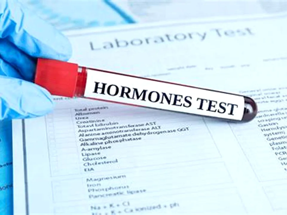 A laboratory technician handling a blood sample tube for hormone testing including estradiol